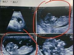 -武汉大学人民医院(首义院区)