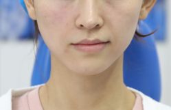 -广州美莱医疗美容医院