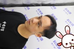 -大麦微针植发丨全国连锁