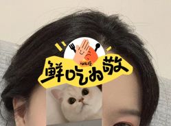 -大麦微针植发全国连锁