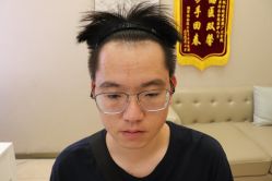 -大麦微针植发丨全国连锁