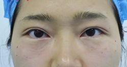 -天津健丽·去眼袋医疗美容机构