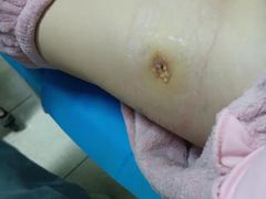 -成都医学院第一附属医院