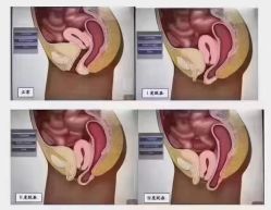 点击看大图 -昕孕瑜伽·孕妇瑜伽·产后修复