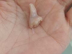 -自然之声助听器·呼吸机(贵定店)