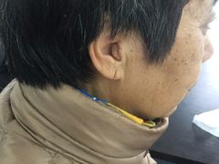 隐形宝山瑞声达助听器-宁耳听力助听器奥迪康·峰力·西门子(宝山店)