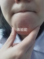 -成都艾特他整形外科医院