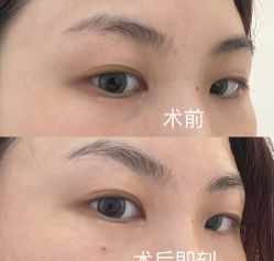-杭州医巢医疗美容