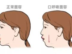 -柏乐口腔(南宁总院)