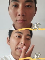 -安徽合肥韩美整形外科医院