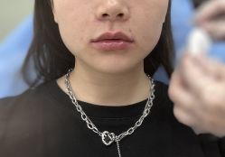 -Yestar重庆艺星医疗美容医院