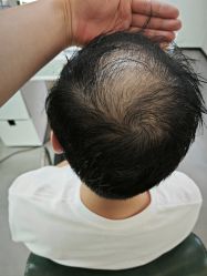 -极客侠男士假发定制补发