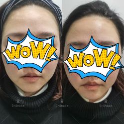 -洁铭新加坡医美