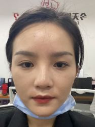 体验前-厦门美莱整形美容医院