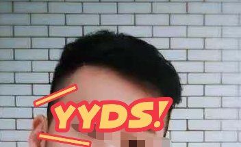 -大麦微针植发丨全国连锁