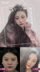 -Yestar艺星医疗美容医院