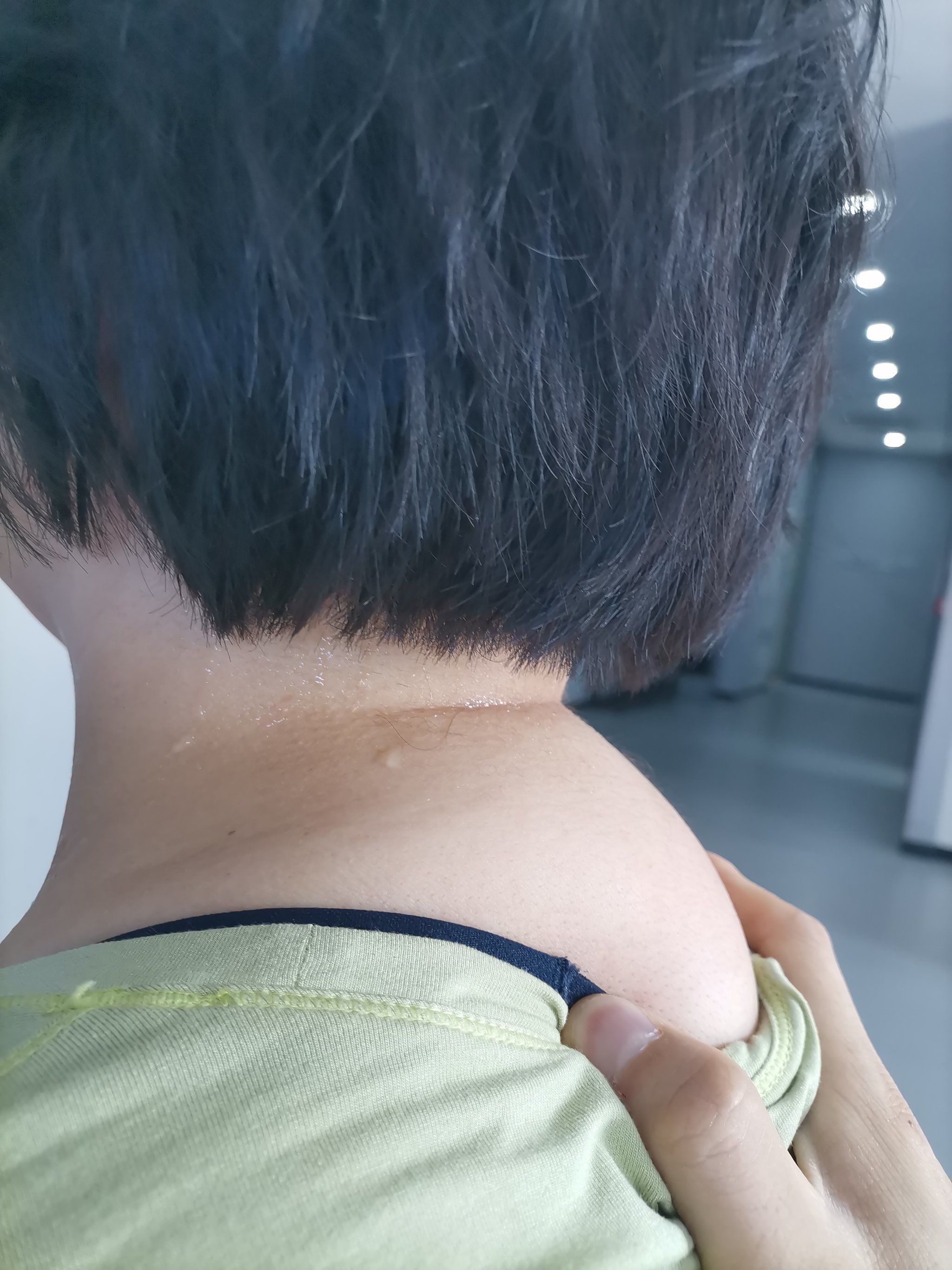 消除富贵包
