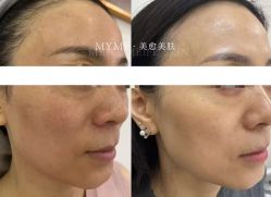 -美愈美肤MEIYU SKIN