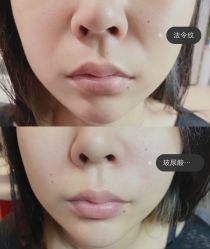 -上海漾颜医疗美容
