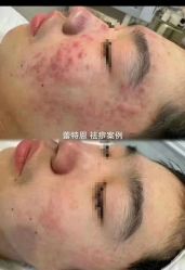 -蕾特恩专业祛痘·皮肤管理