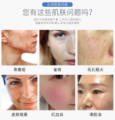 点击看大图 -凡碧诗毛孔清洁收细