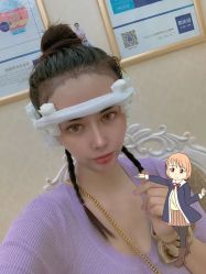 -大麦微针植发丨全国连锁