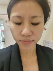 点击看大图 体验后-深圳美莱医疗美容医院