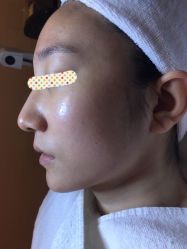 -皇族养心堂·净痘·修敏·御颜