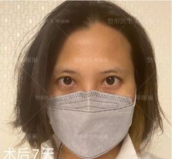 -丰联丽格医疗美容·联合丽格眼整形中心