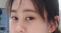 -天津健丽·去眼袋医疗美容机构