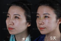 -北京米扬丽格医疗美容·联合丽格鼻整形中心