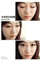 睫毛嫁接-光SPA科技美肤