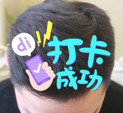 -大麦微针植发全国连锁