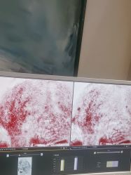 -苑苑vbeauty科技美容SPA
