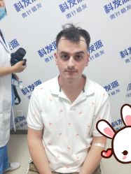 点击看大图 -大麦微针植发丨全国连锁