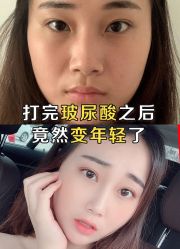 -小忠丽格医美