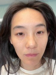 -八大处整形