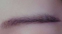 植眉图-丽都整形美容医院·全国连锁旗舰店