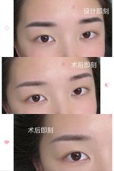 -久匠半永久纹眉