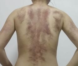 -成都伊贝丝美容美胸SPA会所