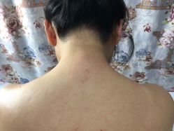 -薇兰专业脱毛连锁机构