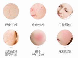-中科妍美专业脱毛美肤连锁机构