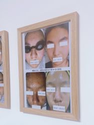 -美肤盾祛痘·问题肌头疗管理中心