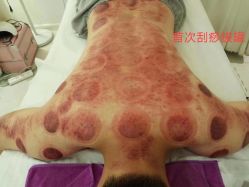 -广生源养发养生馆