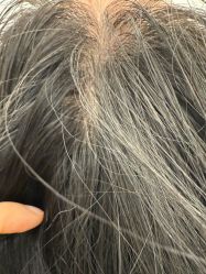 -熙朵美学植发·连锁品牌