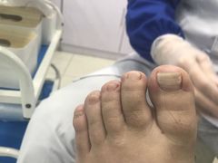 -世龙世家甲沟炎·灰指甲·嵌甲矫正·修脚(武侯区双楠店)