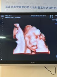 -杭州贝瑞斯美华妇儿医院·早孕·产检·儿科