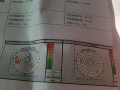 -天津大学爱尔眼科医院(天津总院)