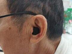 -自然之声助听器(平凉店)
