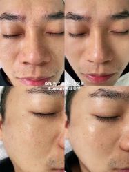 -E.beauty驻颜·痘敏肌调理中心